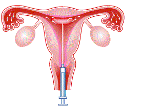 し 寿命 せい 精子と卵子の寿命はどれくらい？妊娠する仕組みについて解説